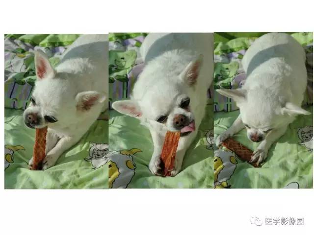 【PPT】鼻腔鼻窦肿瘤与肿瘤样病变的影像学诊断分析思路