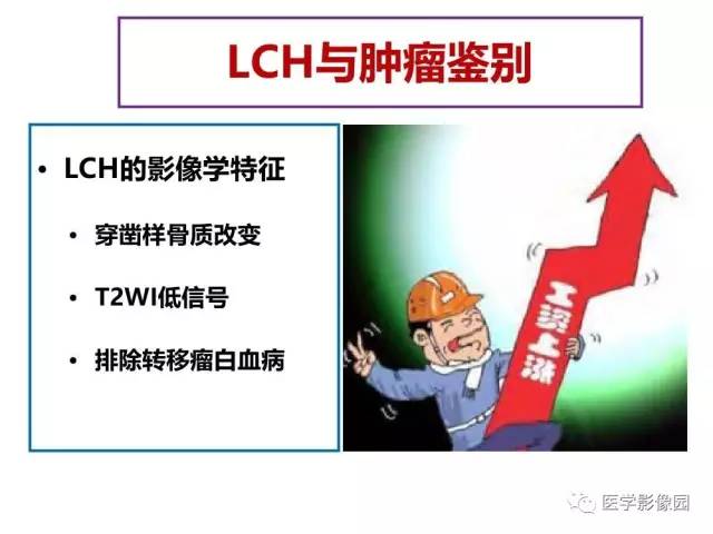 【PPT】鼻腔鼻窦肿瘤与肿瘤样病变的影像学诊断分析思路