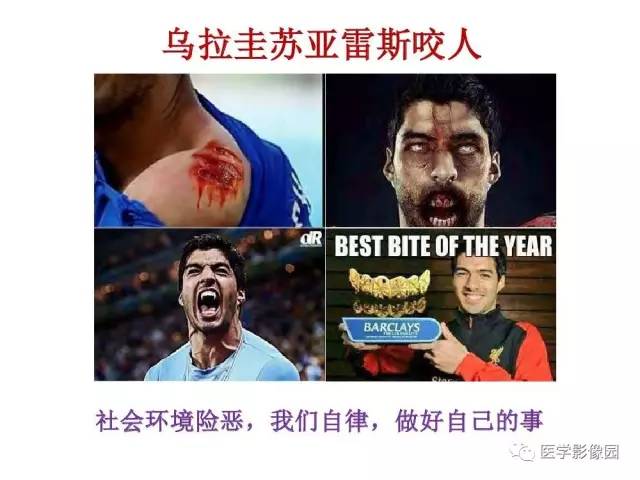 【PPT】鼻腔鼻窦肿瘤与肿瘤样病变的影像学诊断分析思路