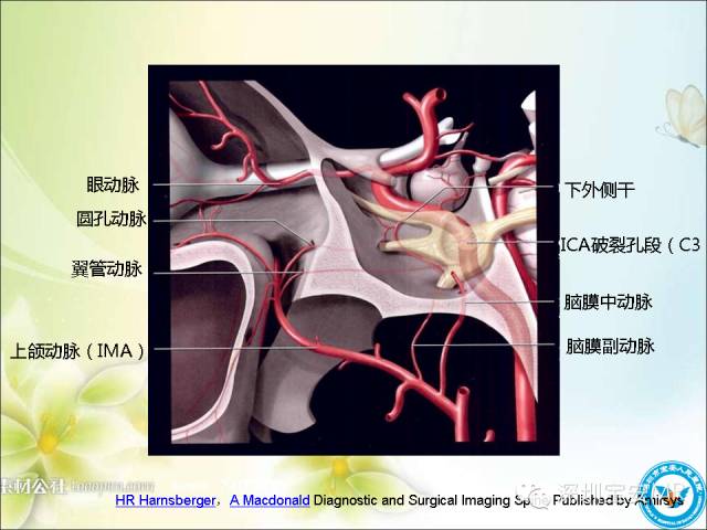 【PPT】颈内动脉颅内段影像解剖(附临床血管病例)