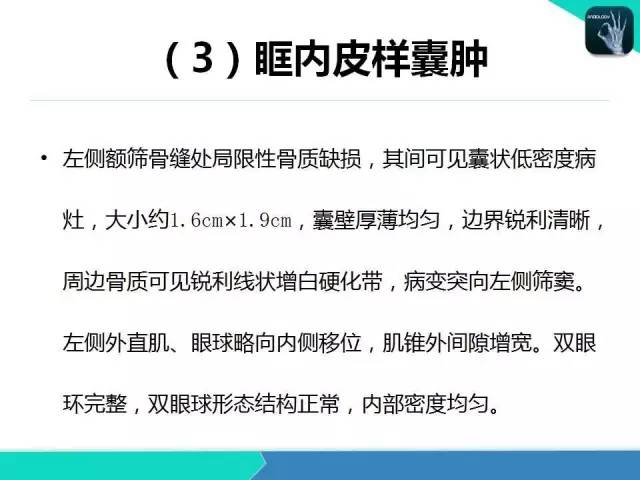 【PPT】头颈部CT诊断报告书写