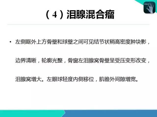 【PPT】头颈部CT诊断报告书写