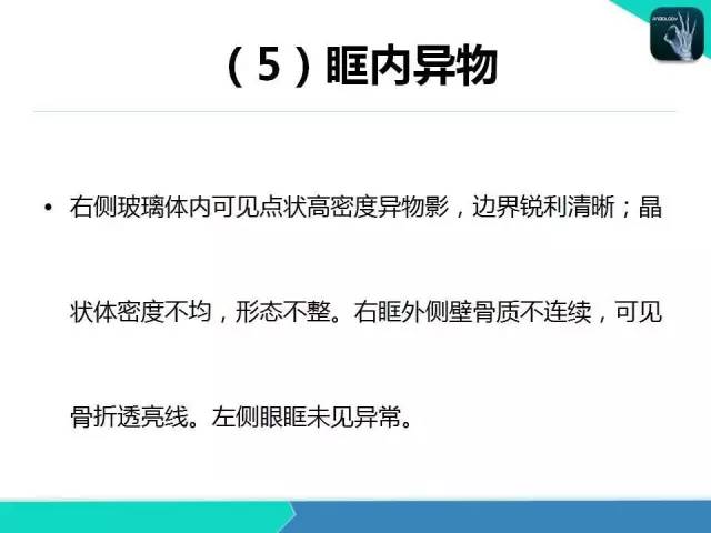 【PPT】头颈部CT诊断报告书写