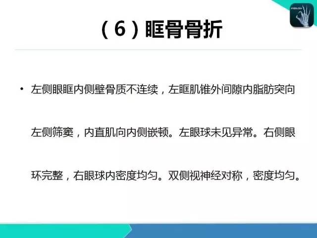 【PPT】头颈部CT诊断报告书写