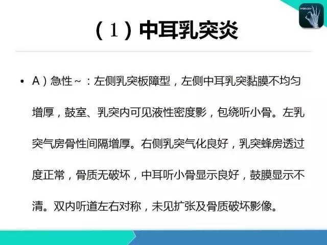 【PPT】头颈部CT诊断报告书写