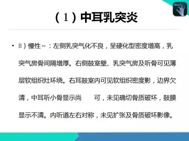 【PPT】头颈部CT诊断报告书写