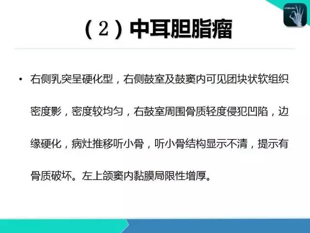 【PPT】头颈部CT诊断报告书写