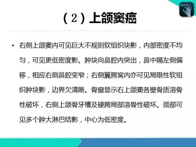【PPT】头颈部CT诊断报告书写