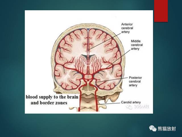 【PPT】脱髓鞘疾病、腔隙性脑梗死与血管周围间隙的鉴别诊断 【PPT】脱髓鞘疾病、腔隙性脑梗死与血管周围间隙的鉴别诊断