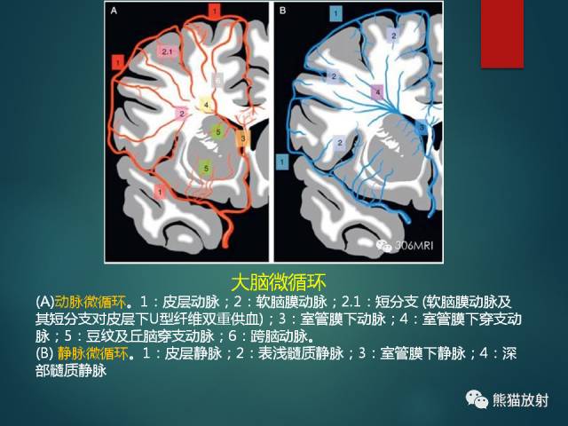 【PPT】脱髓鞘疾病、腔隙性脑梗死与血管周围间隙的鉴别诊断 【PPT】脱髓鞘疾病、腔隙性脑梗死与血管周围间隙的鉴别诊断