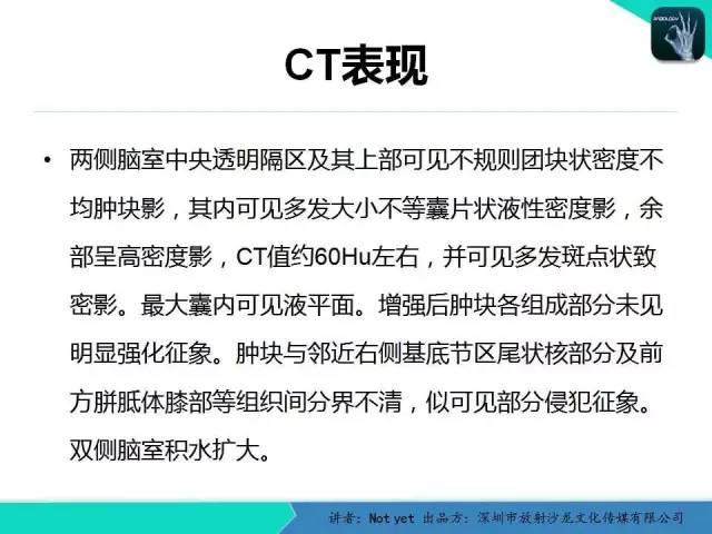 【病例】脑室内脉管瘤1例CT及MR影像诊断与鉴别