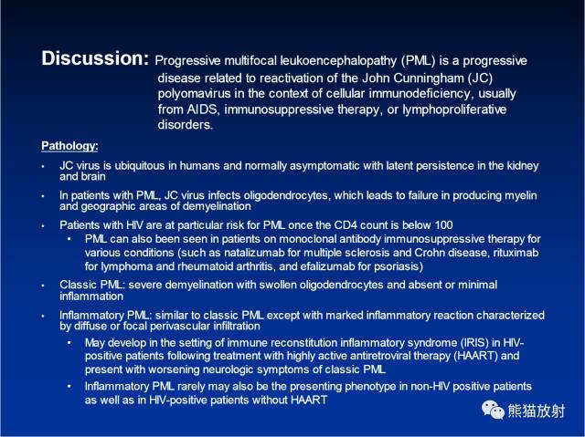 【病例】进行性多灶性白质脑病PML三例MR影像表现