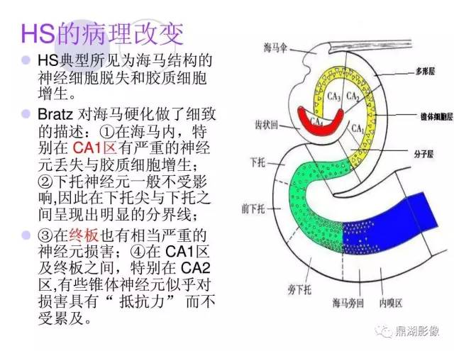 【PPT】海马硬化性颞叶癫痫的MRI探索研究