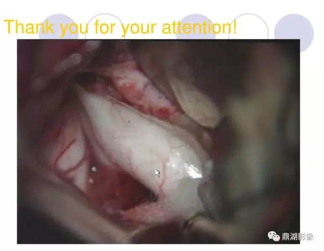【PPT】海马硬化性颞叶癫痫的MRI探索研究