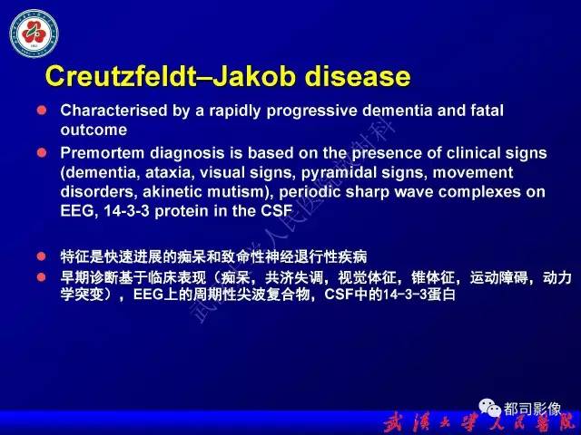 【PPT】皮层异常信号病变MRI诊断