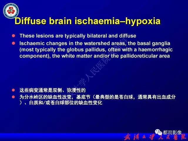 【PPT】皮层异常信号病变MRI诊断