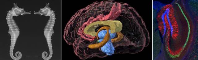 带你认识神秘的海马体