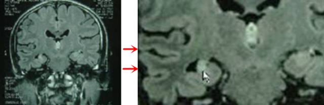 带你认识神秘的海马体
