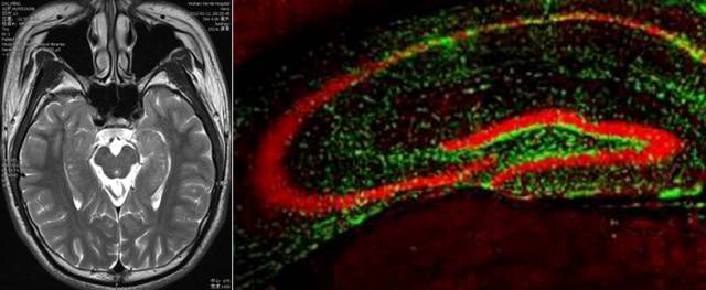 带你认识神秘的海马体