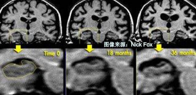 带你认识神秘的海马体