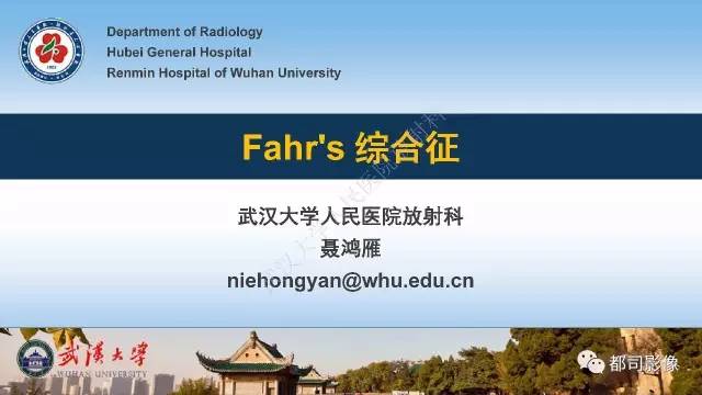 【PPT】Fahr's综合征