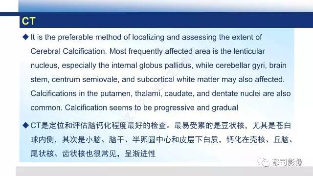 【PPT】Fahr's综合征