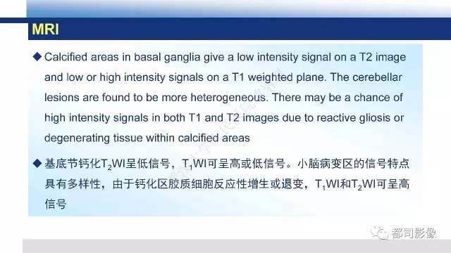 【PPT】Fahr's综合征