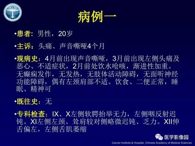【病例】左侧颈静脉孔区脊索瘤1例MR影像表现