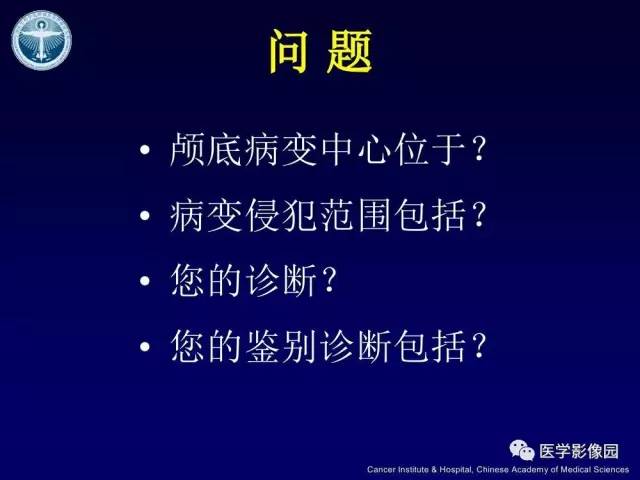 【病例】左侧颈静脉孔区脊索瘤1例MR影像表现