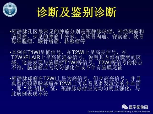 【病例】左侧颈静脉孔区脊索瘤1例MR影像表现