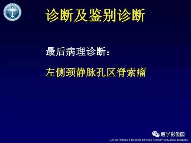 【病例】左侧颈静脉孔区脊索瘤1例MR影像表现