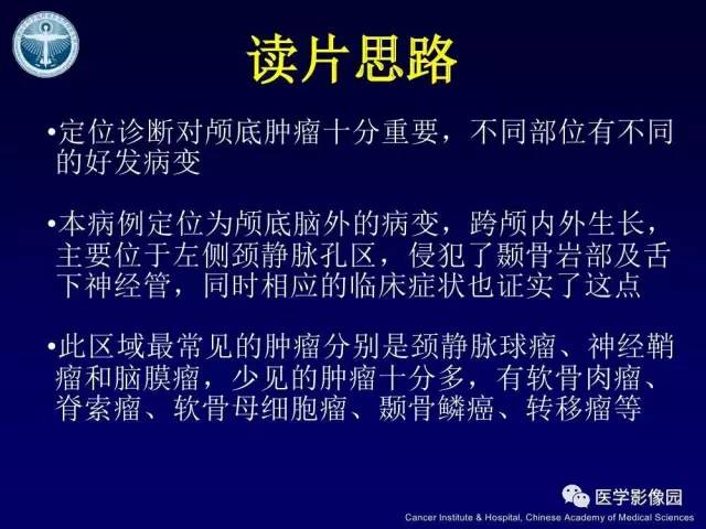 【病例】左侧颈静脉孔区脊索瘤1例MR影像表现
