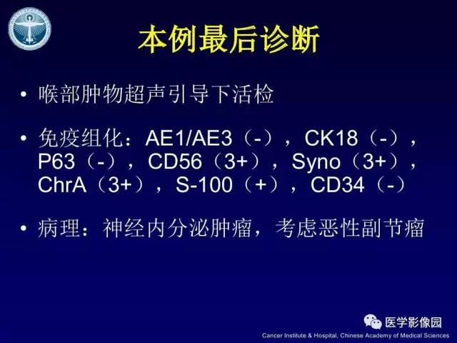 【病例】右侧颈静脉孔区副神经节瘤1例CT影像表现