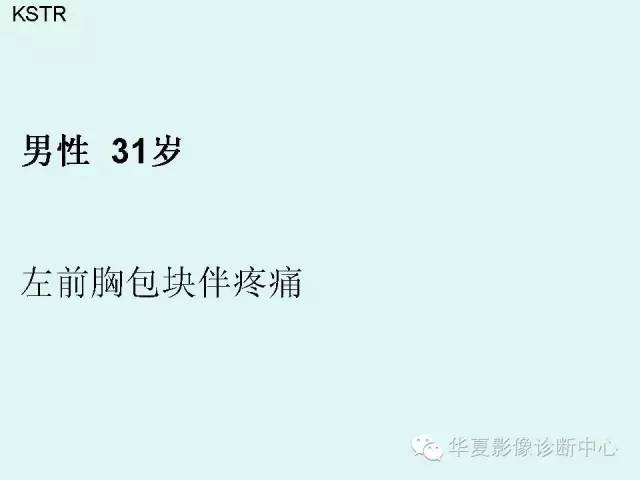【病例】锁骨结核一例CT及MR影像表现