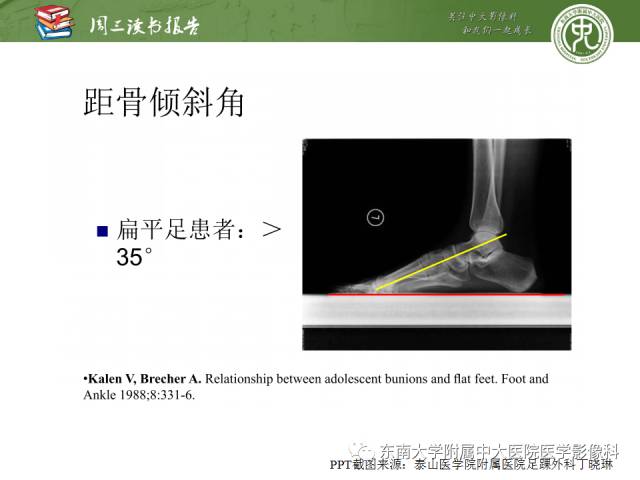 【PPT】踝及足术后CT和MR成像