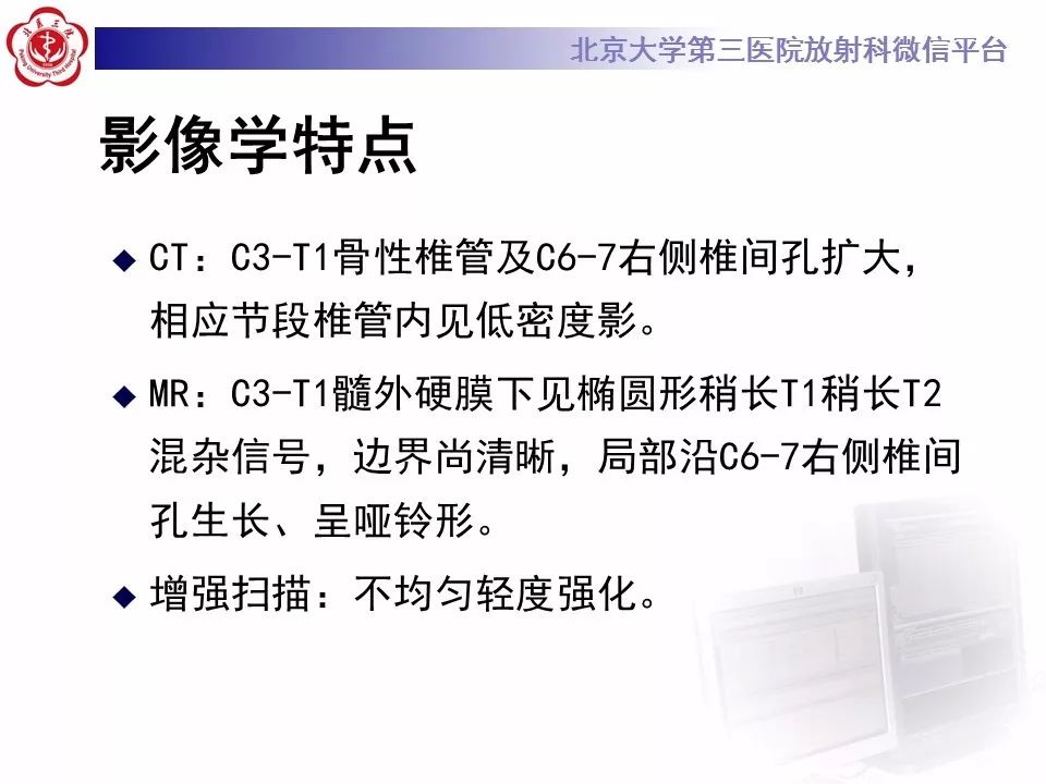 【病例】颈椎椎管内节细胞神经瘤1例MR