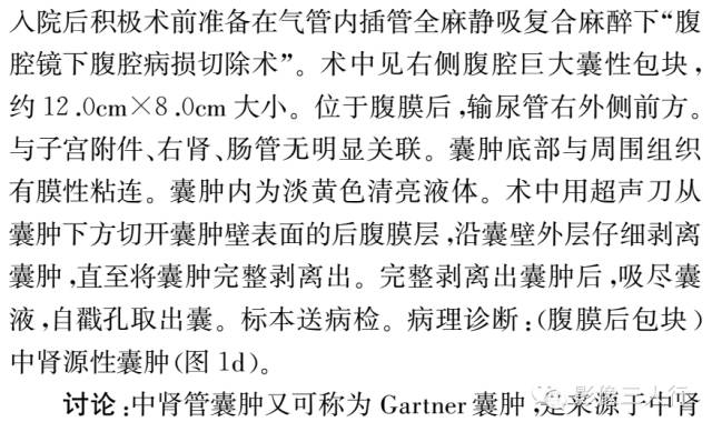 【病例】腹膜后巨大中肾源性囊肿1例