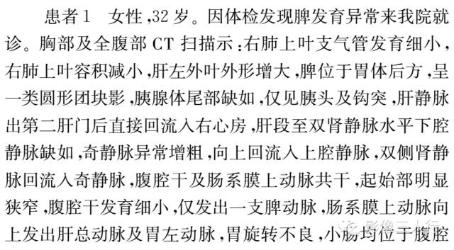 【病例】成人多脾综合征2例