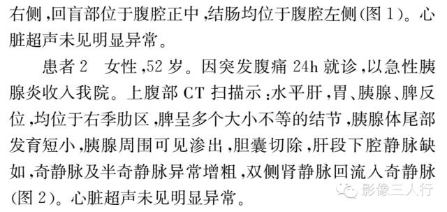 【病例】成人多脾综合征2例