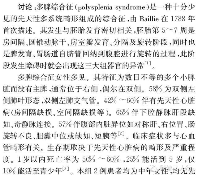 【病例】成人多脾综合征2例