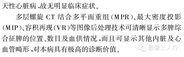 【病例】成人多脾综合征2例