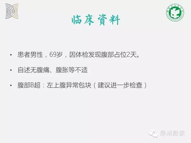 【病例】小肠胃肠道间质瘤1例CT影像表现