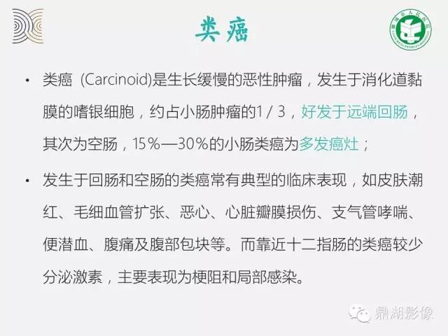 【病例】小肠胃肠道间质瘤1例CT影像表现