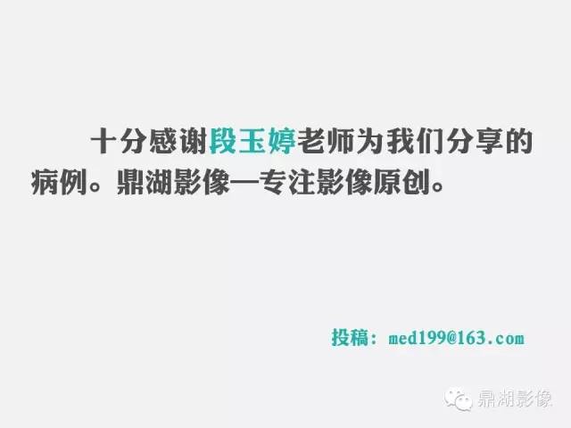 【病例】小肠胃肠道间质瘤1例CT影像表现