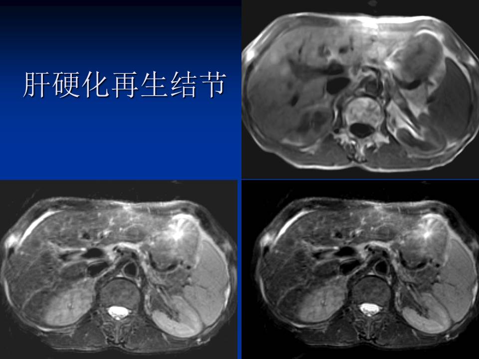 幻灯片53