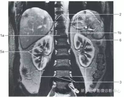 肾脏的一些重要影像数据