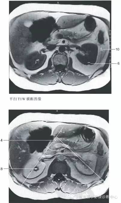 肾脏的一些重要影像数据