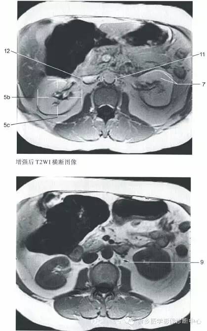 肾脏的一些重要影像数据