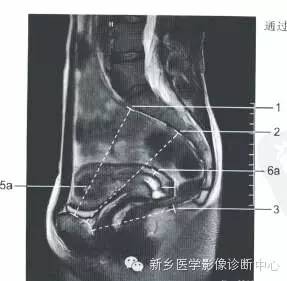 男女盆腔的一些重要影像数据