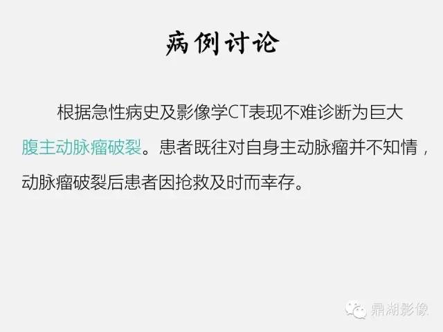 【病例】巨大腹主动脉瘤破裂1例CT影像表现